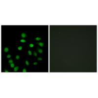 SCAND1 Antibody