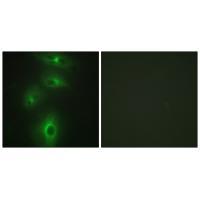TMPRSS3 Antibody