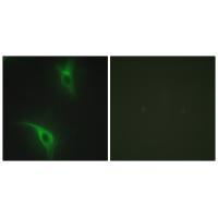 CKS1 Antibody