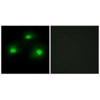 IPKA Antibody