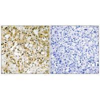 TFAM Antibody