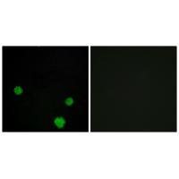 HLX1 Antibody