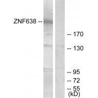 ZNF638 Antibody