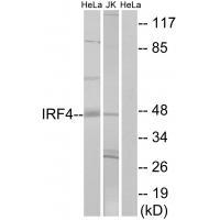 IRF4 Antibody 