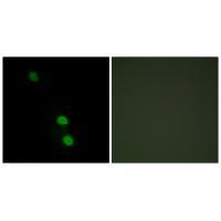 TEAD2 Antibody