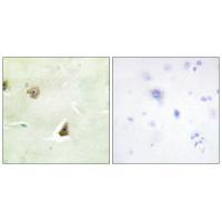 DUSP6 Antibody 