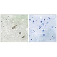 DGKK Antibody 