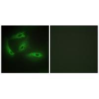 CDKL4 Antibody 