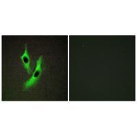 STEAP4 Antibody