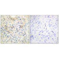 TM16G Antibody 