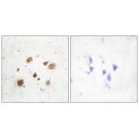 CaMK1-β Antibody 