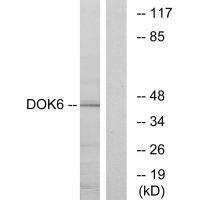 DOK6 Antibody
