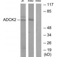ADCK2 Antibody 