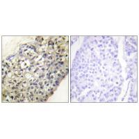 LATH Antibody
