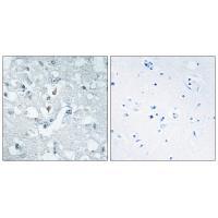 GLCTK Antibody 
