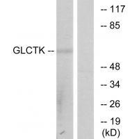 GLCTK Antibody 