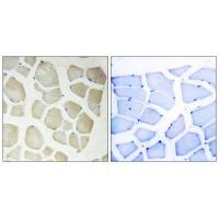 CDKL3 Antibody