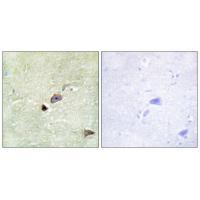 TRIM59 Antibody 