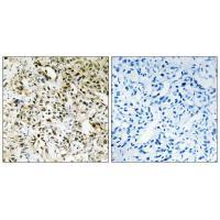 PPHLN Antibody