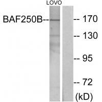 BAF250B Antibody 