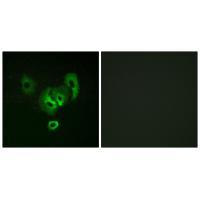 STEA2 Antibody 