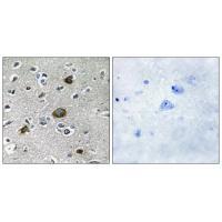 AKAP1 Antibody 