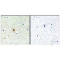 TAF15 Antibody 