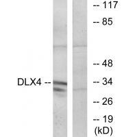 DLX4 Antibody
