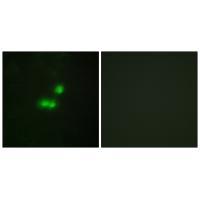 TF3B Antibody 