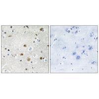 TF3B Antibody 
