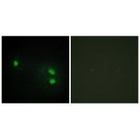 Histone H2B Antibody