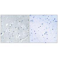 Histone H2B Antibody