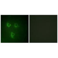 TMEPA Antibody 