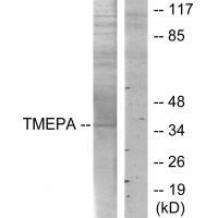 TMEPA Antibody 