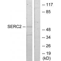 SERC2 Antibody 