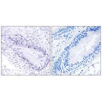 TEP1 Antibody 