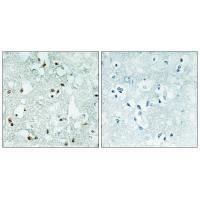 ELAC2 Antibody 
