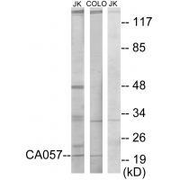 CA057 Antibody 