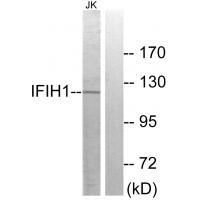 IFIH1 Antibody 