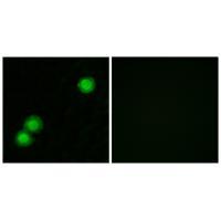 IPKB Antibody