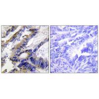 ILKAP Antibody