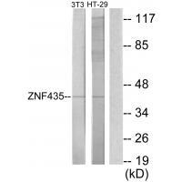 ZNF435 Antibody 