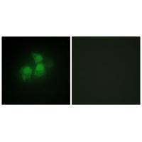 IPPK Antibody 