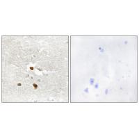ZNF287 Antibody 
