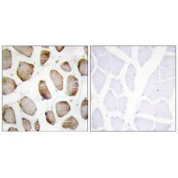 DUS2L Antibody 