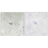 ARMX3 Antibody