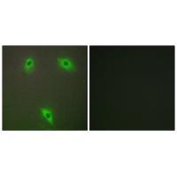 KLHL3 Antibody 