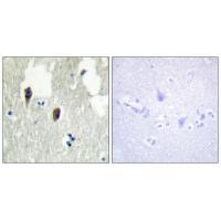 KLHL3 Antibody 