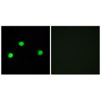 IP6K2 Antibody 