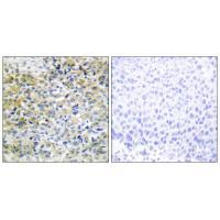 CARKL Antibody 